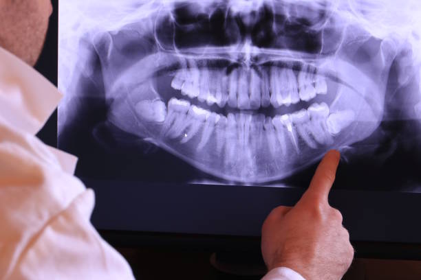 Best Emergency Dental Care for Broken or Chipped Teeth in Lahoma City, OK