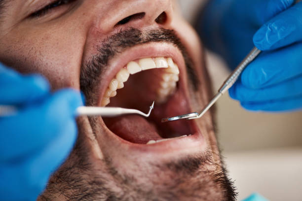 Best Cosmetic Emergency Dentistry in Lahoma City, OK
